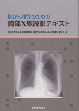 肺がん検診のための胸部X線読影テキスト